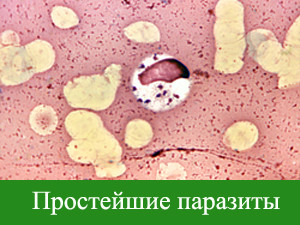 простейшие паразиты под микроскопом